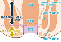 肛門ボトックスのイメージ