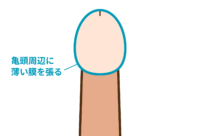 早漏解決＋亀頭のサイズアップ（スーパーヒアルロン酸注入）