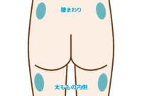 豊尻：腰回りや太ももの内側にも